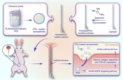 Inhibition of urethral stricture by a catheter loaded with nanoparticle/ pirfenidone complexes